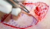 Anophthalmic cavity 11