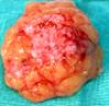Anophthalmic cavity 12