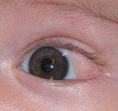 Congenital malformations 6