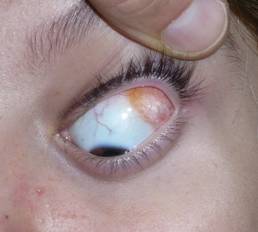 Congenital malformations 9