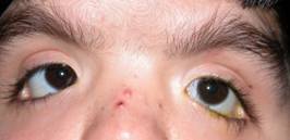 Congenital malformations 16
