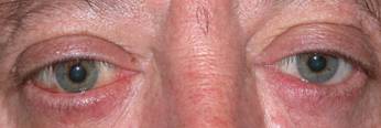 Thyroid 21