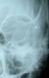 Traumatologia 7
